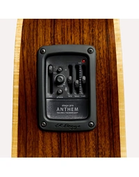 Baggs Anthem Stage Pro Active Acoustic Guitar Undersaddle Pickup & Microphone System w/ Preamp